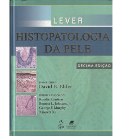 Lever - Histopatologia da Pele